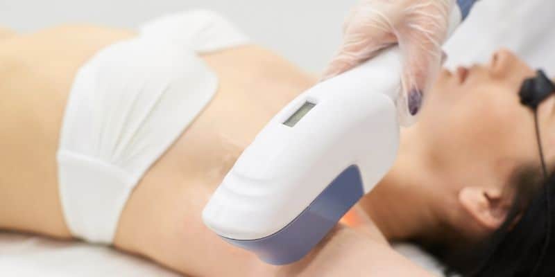 woman undergoing laser hair removal